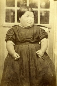 Hawaii or Asia? Sad Chubby Young Girl Child Portrait Old CDV Photo 1860's