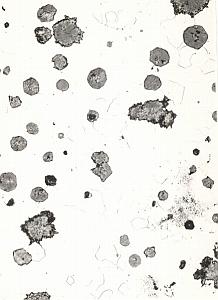 Metallography Iron Steel Study France Micrograph Abstract Photo 1960